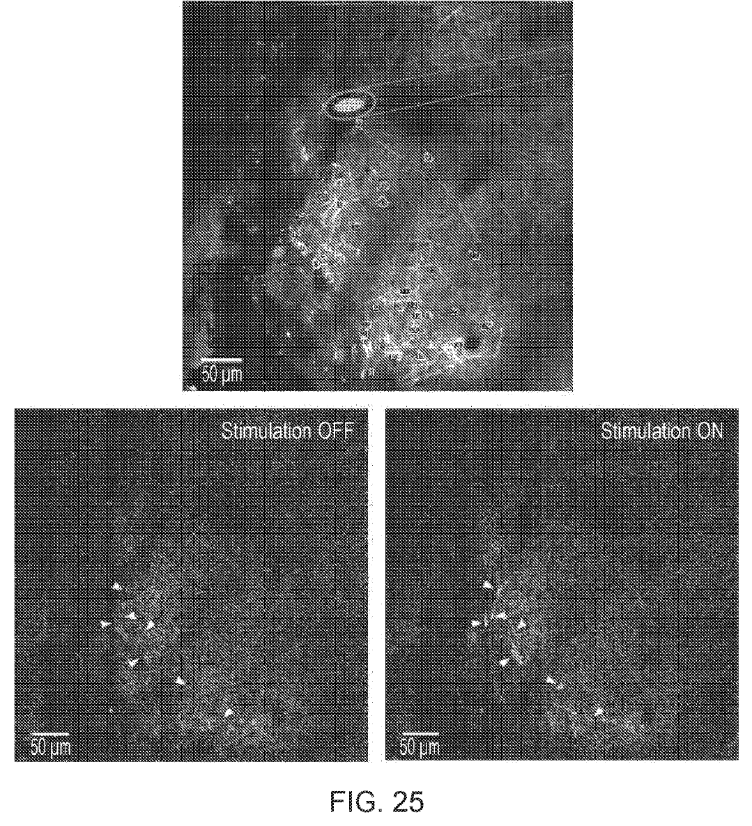 Three two-photon microscope images. Top: the field of view with the probe tip outlined and numbered cells. Bottom left: stimulation off. Bottom right: stimulation on, with brighter cells marked by arrowheads. Scale bars 50 micrometres.